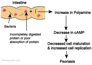 Possible mechanism of psoriasis